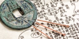 Acupuncture needles and ancient medicine book